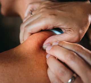 Physiotherapeutin bei PhysioSport Köln prüft Einstichpunkte im Nacken für Osteopathie und Dry Needling.